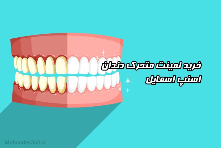 خرید لمینت متحرک دندان اسنپ اسمایل